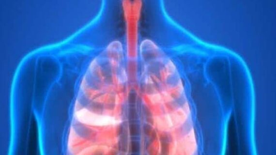 ऑस्टियोपोरोसिस से पीड़ित मरीजों के लिए वायु प्रदूषण घातक
