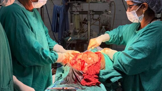 महिला के पेट से निकाला 20 किलो का ट्यूमर