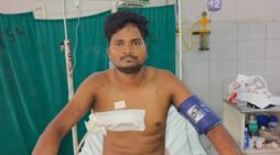केजीएमयू ट्रॉमा सेंटर में जटिल जीवनरक्षक ऑपरेशन से 34 वर्षीय युवक की बची जान
